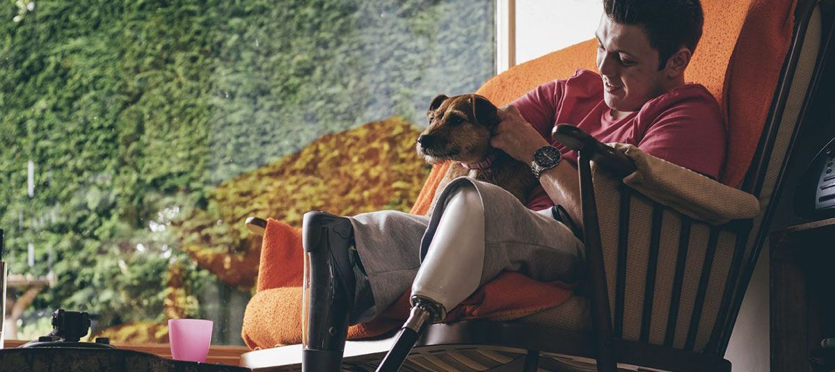 Person with Amputee holding their dog in their home.