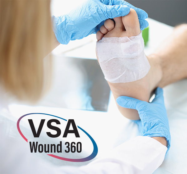 VSA Wound 360 overlaying an image of an injured foot.