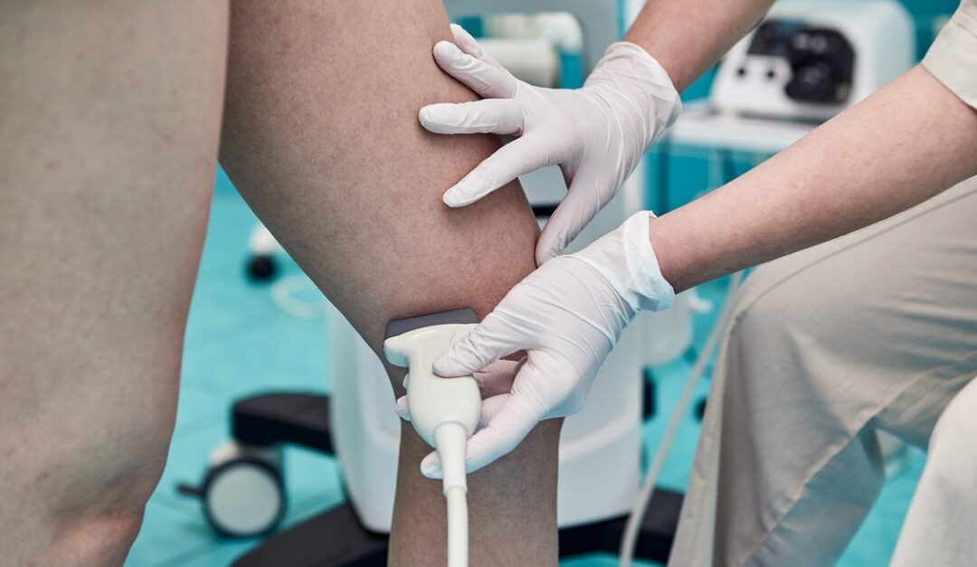 Doctor performing ultrasound on leg