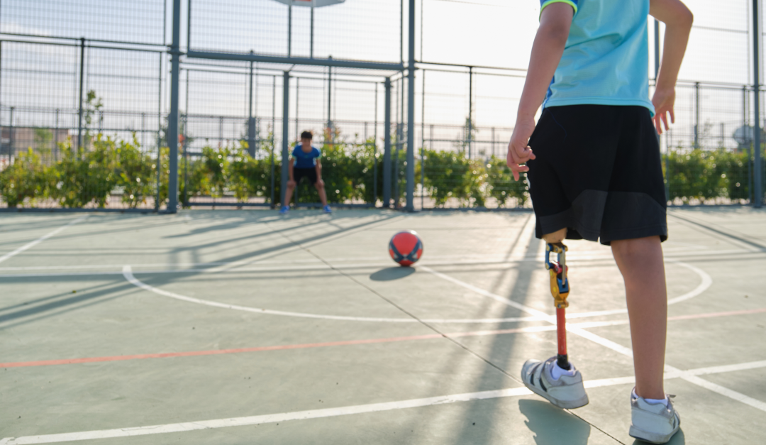Young person with prosthetic leg playing
