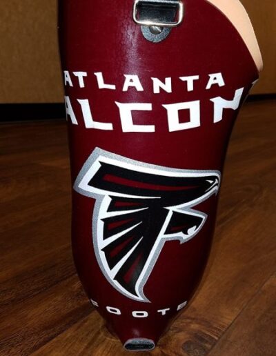 Atlanta Falcons design on Prosthetic