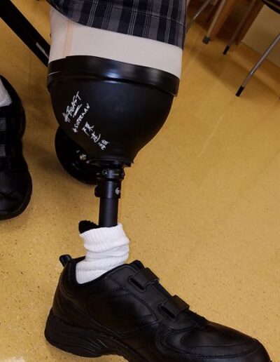 Autographed prosthetic