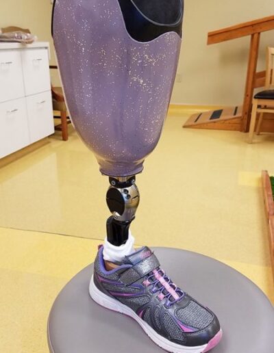 Lavendar prosthetic design
