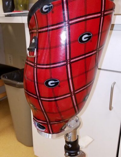 UGA prosthetic design