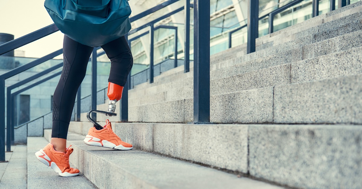 Woman in leg prosthesis in sports clothing