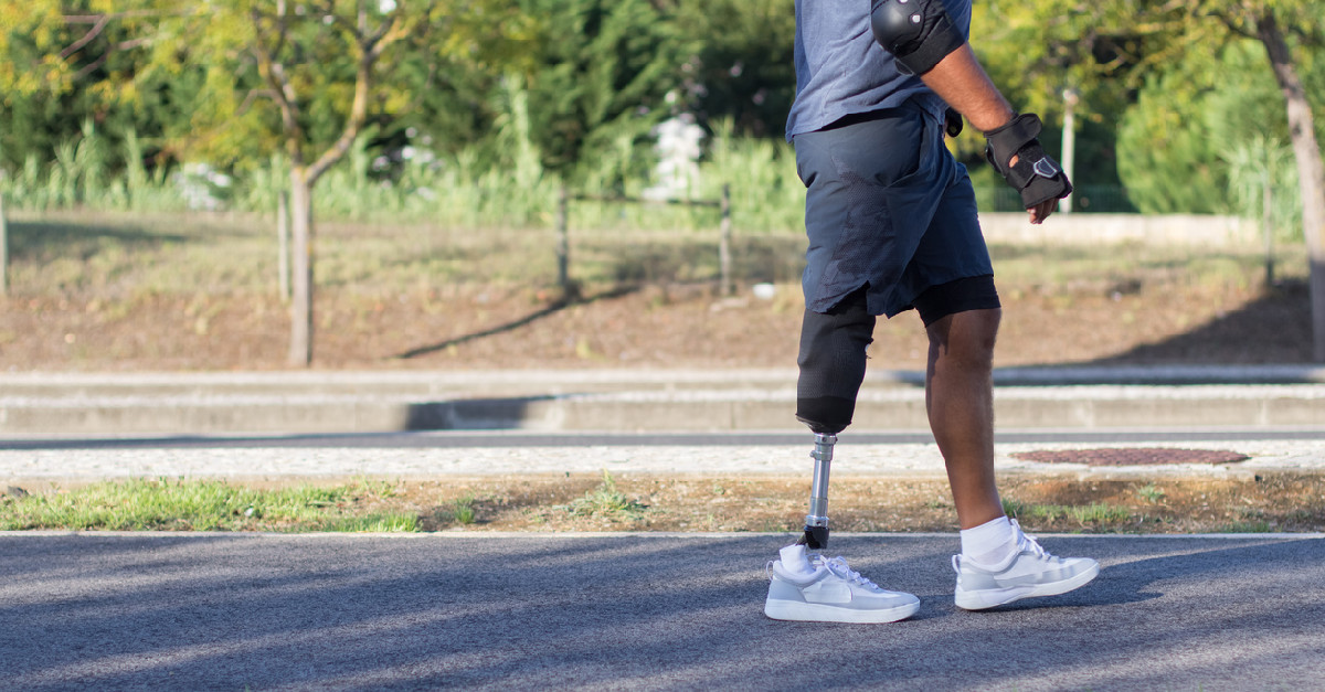Man walking with prosthetic leg